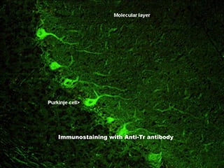 Immunostaining with Anti-Tr antibody

10:41 PM

 