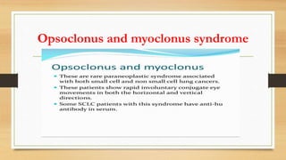 Opsoclonus and myoclonus syndrome
 