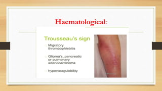 Haematological:
 