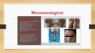 Rheumatological:
 