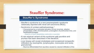 Stauffer Syndrome:
 