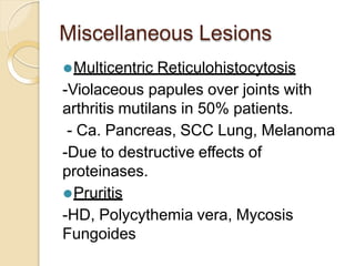 Miscellaneous Lesions
⚫Multicentric Reticulohistocytosis
-Violaceous papules over joints with
arthritis mutilans in 50% patients.
- Ca. Pancreas, SCC Lung, Melanoma
-Due to destructive effects of
proteinases.
⚫Pruritis
-HD, Polycythemia vera, Mycosis
Fungoides
 