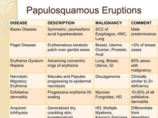 Papulosquamous Eruptions
DISEASE DESCRIPTION MALIGNANCY COMMENT
Bazex Disease Symmetric, psoriasiform
acral hyperkeratosis
SCC of
Esophagus, HNC,
Lung
Male
predominance
Paget Disease Erythematous keratotic
patch over genital areas
Breast, Uterine,
Ovarian, Prostate,
Anal
<3% of breast
cases
Erythema Gyratum
Repens
Advancing concentric
rings of erythema
Lung, Breast,
Uterus, GI
80% assoc
with
malignancy
Necrolytic
Migratory
Erythema
Macules and Papules
progressing to epidermal
necrolysis
Glucaganoma Clinically
similar to Zn
deficiency
Exfoliative
dermatitis
Progressive erythema f/b
scaling
Mycosis
Fungoides, HD
10-20% of all
exfoliative
dermatitis
Acquired
Ichthyosis
Generalized dry,
crackling skin,
HD, Multiple
Myeloma,
Differentiate
from
 
