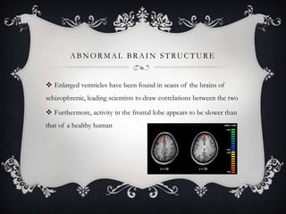 ABNORMAL BRAIN STRUCTURE
 Enlarged ventricles have been found in scans of the brains of
schizophrenic, leading scientists to draw correlations between the two
 Furthermore, activity in the frontal lobe appears to be slower than
that of a healthy human
 