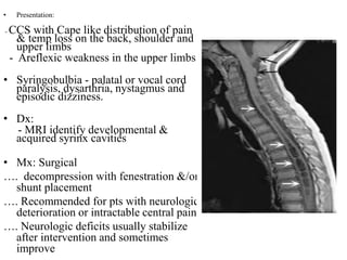 • Presentation:
- CCS with Cape like distribution of pain
& temp loss on the back, shoulder and
upper limbs
- Areflexic weakness in the upper limbs
• Syringobulbia - palatal or vocal cord
paralysis, dysarthria, nystagmus and
episodic dizziness.
• Dx:
- MRI identify developmental &
acquired syrinx cavities
• Mx: Surgical
…. decompression with fenestration &/or
shunt placement
…. Recommended for pts with neurologic
deterioration or intractable central pain
…. Neurologic deficits usually stabilize
after intervention and sometimes
improve
 