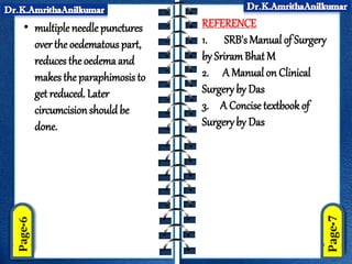 • multiple needle punctures
over the oedematous part,
reduces the oedema and
makes the paraphimosis to
get reduced. Later
circumcisionshould be
done.
REFERENCE
1. SRB's Manual of Surgery
by SriramBhat M
2. A Manual on Clinical
Surgeryby Das
3. A Concise textbookof
Surgeryby Das
 
