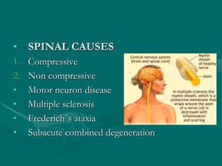 • SPINAL CAUSES
1. Compressive
2. Non compressive
• Motor neuron disease
• Multiple sclerosis
• Frederich`s ataxia
• Subacute combined degeneration
 