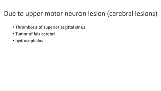 Due to upper motor neuron lesion (cerebral lesions)
• Thrombosis of superior sagittal sinus
• Tumor of falx cerebri
• hydrocephalus
 