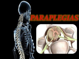 PARAPLEGIAS