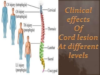 Clinical effectsOf Cord lesionAt differentlevels