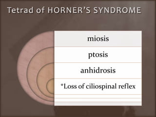 Tetrad of HORNER’S SYNDROME