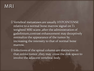 MRIVertebral metastases are usually HYPOINTENSE relative to a normal bone marrow signal on T1 weighted MRI scans ,after the administration of gadolinium,contrast enhancement may deceptively normalize the appearance of the tumor by increasing the intensity to that of normal bone marrow.Infections of the spinal column are distinctive in that,unlike tumor ,they may  cross the disk space to involve the adjacent vertebral body.