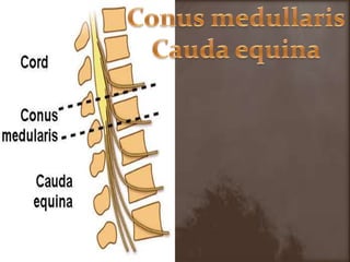 ConusmedullarisCaudaequina