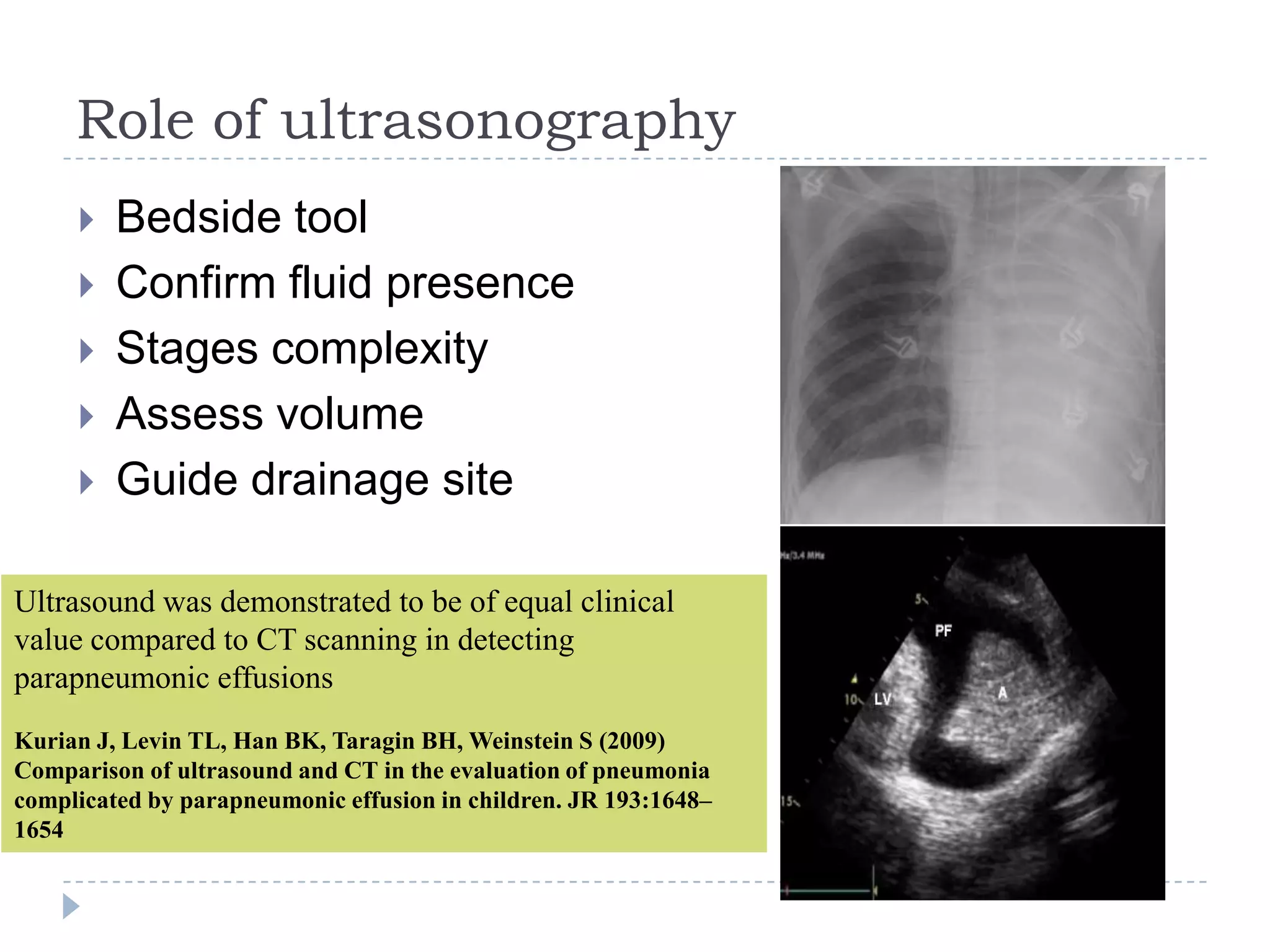 Role of ultrasonography
 Bedside tool
 Confirm fluid presence
 Stages complexity
 Assess volume
 Guide drainage site
Ultrasound was demonstrated to be of equal clinical
value compared to CT scanning in detecting
parapneumonic effusions
Kurian J, Levin TL, Han BK, Taragin BH, Weinstein S (2009)
Comparison of ultrasound and CT in the evaluation of pneumonia
complicated by parapneumonic effusion in children. JR 193:1648–
1654
 