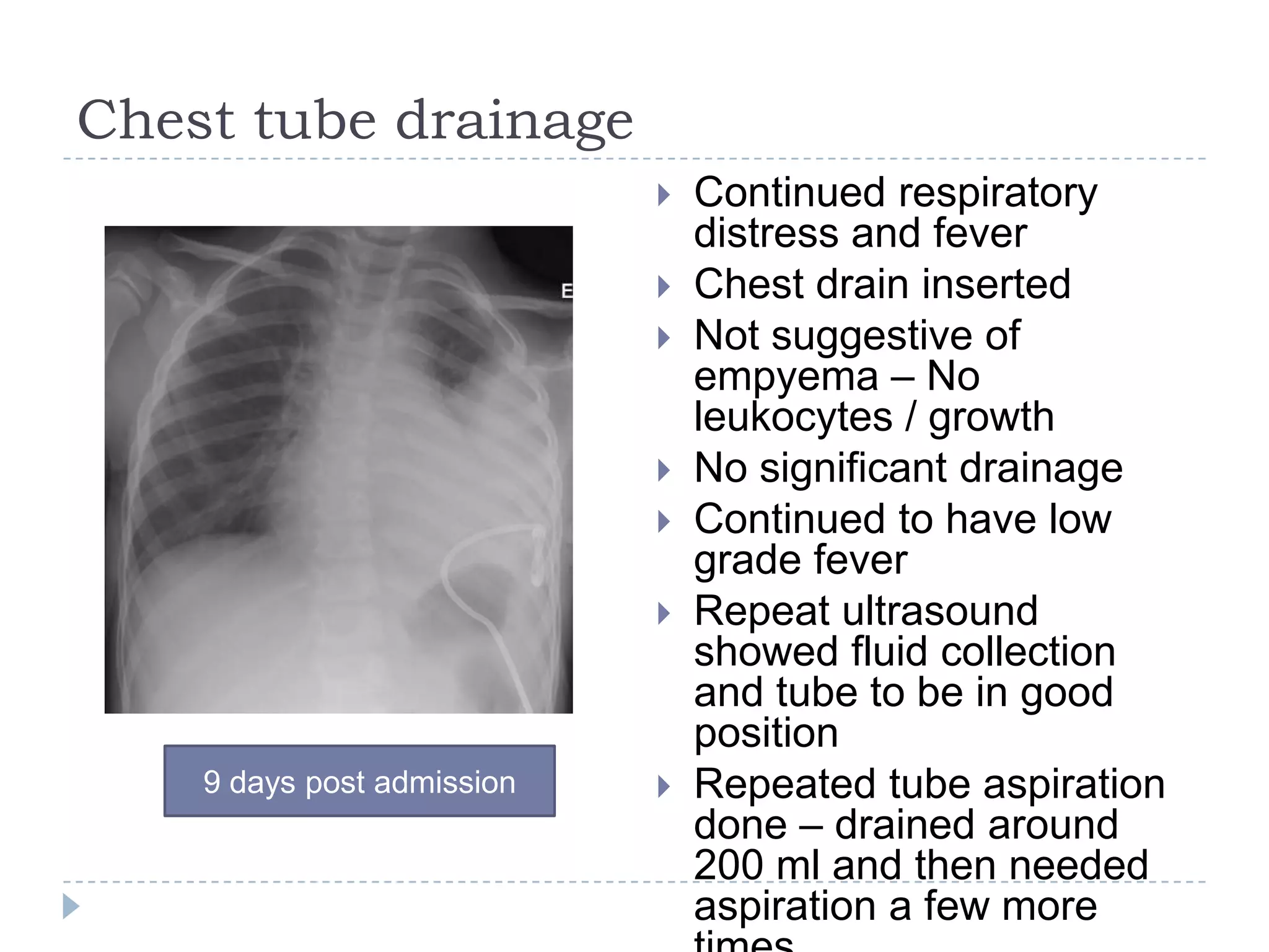 Chest tube drainage
 Continued respiratory
distress and fever
 Chest drain inserted
 Not suggestive of
empyema – No
leukocytes / growth
 No significant drainage
 Continued to have low
grade fever
 Repeat ultrasound
showed fluid collection
and tube to be in good
position
 Repeated tube aspiration
done – drained around
200 ml and then needed
aspiration a few more
9 days post admission
 