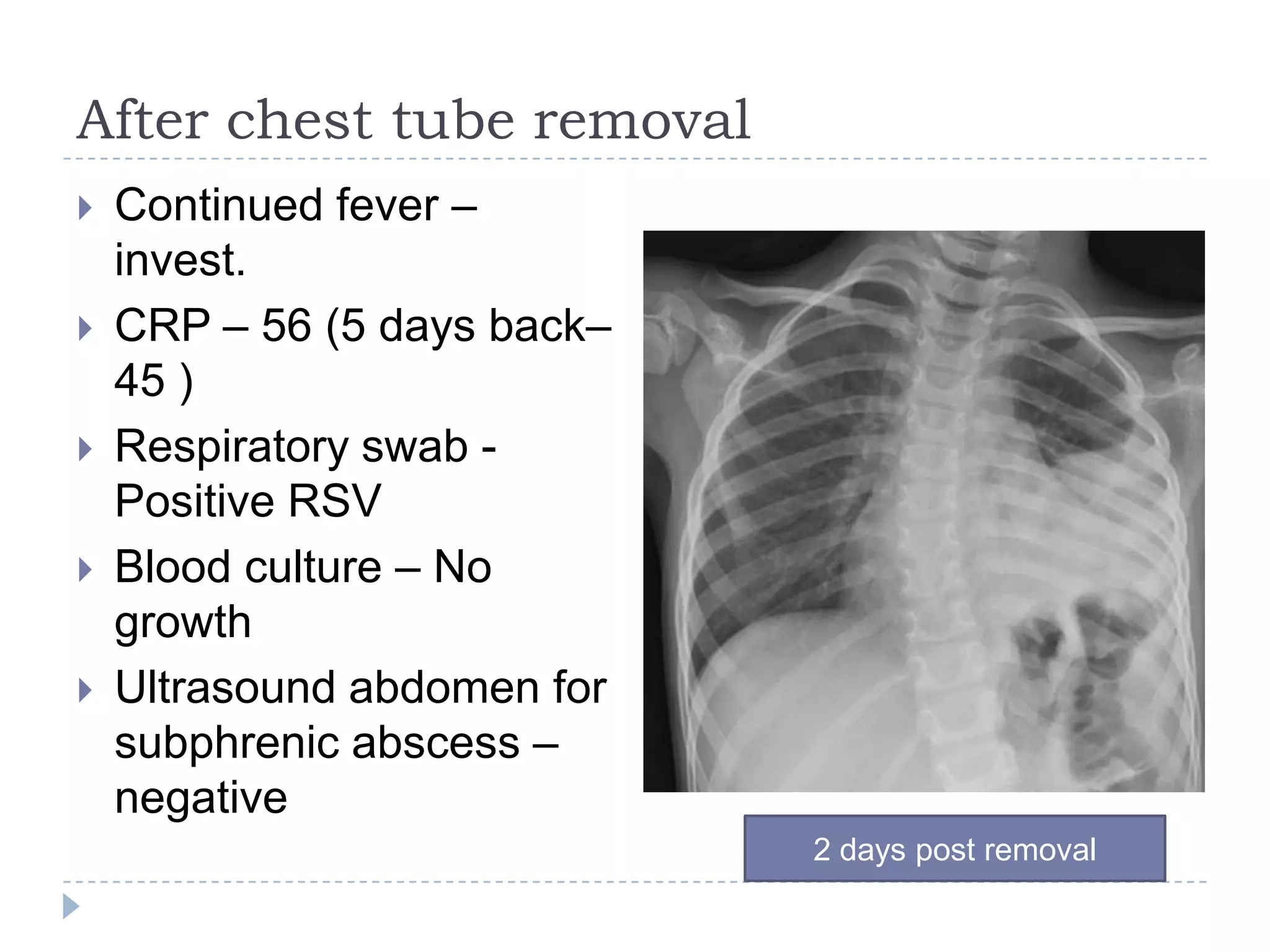 After chest tube removal
 Continued fever –
invest.
 CRP – 56 (5 days back–
45 )
 Respiratory swab -
Positive RSV
 Blood culture – No
growth
 Ultrasound abdomen for
subphrenic abscess –
negative
2 days post removal
 