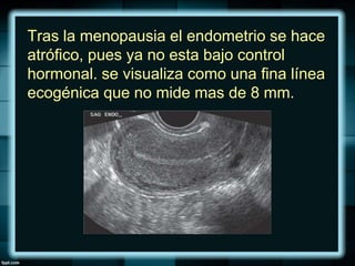 Tras la menopausia el endometrio se hace
atrófico, pues ya no esta bajo control
hormonal. se visualiza como una fina línea
ecogénica que no mide mas de 8 mm.
 