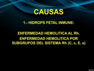 CAUSAS
1.- HIDROPS FETAL INMUNE:
ENFERMEDAD HEMOLITICA AL Rh.
ENFERMEDAD HEMOLITICA POR
SUBGRUPOS DEL SISTEMA Rh (C, c, E, e)
 