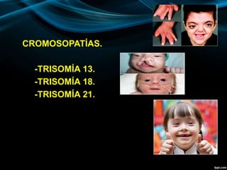 CROMOSOPATÍAS.
-TRISOMÍA 13.
-TRISOMÍA 18.
-TRISOMÍA 21.
 