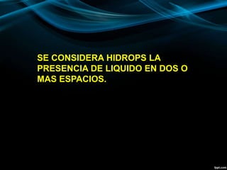 SE CONSIDERA HIDROPS LA
PRESENCIA DE LIQUIDO EN DOS O
MAS ESPACIOS.
 