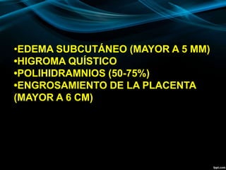 •EDEMA SUBCUTÁNEO (MAYOR A 5 MM)
•HIGROMA QUÍSTICO
•POLIHIDRAMNIOS (50-75%)
•ENGROSAMIENTO DE LA PLACENTA
(MAYOR A 6 CM)
 