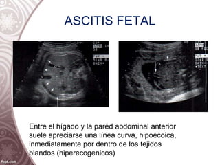 Abdomen Fetal