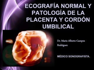 Page 1
ECOGRAFÍA NORMAL Y
PATOLOGÍA DE LA
PLACENTA Y CORDÓN
UMBILICAL
Dr. Mario Alberto Campos
Rodríguez
MÉDICO SONOGRAFISTA.
 