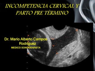 Page 1
INCOMPETENCIA CERVICAL Y
PARTO PRE TÉRMINO
Dr. Mario Alberto Campos
Rodríguez
MEDICO SONOGRAFISTA
 