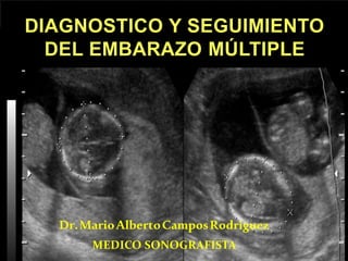 Dr.MarioAlbertoCamposRodríguez
MEDICO SONOGRAFISTA
DIAGNOSTICO Y SEGUIMIENTO
DEL EMBARAZO MÚLTIPLE
 