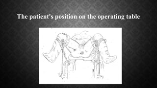 The patient's position on the operating table
 
