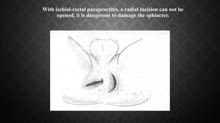 With ischial-rectal paraproctitis, a radial incision can not be
opened, it is dangerous to damage the sphincter.
 