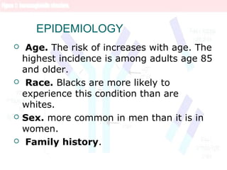 EPIDEMIOLOGY
 Age. The risk of increases with age. The
highest incidence is among adults age 85
and older.
 Race. Blacks are more likely to
experience this condition than are
whites.
 Sex. more common in men than it is in
women.
 Family history.
 