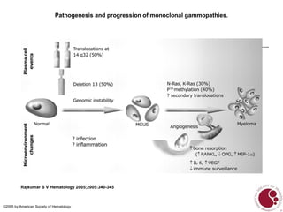 Pathogenesis and progression of monoclonal gammopathies.
Rajkumar S V Hematology 2005;2005:340-345
©2005 by American Society of Hematology
 