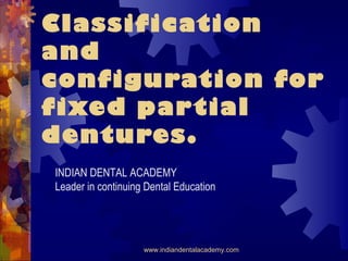 Classification
and
configuration for
fixed partial
dentures.
INDIAN DENTAL ACADEMY
Leader in continuing Dental Education
www.indiandentalacademy.com
 