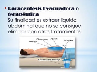 • Paracentesis Evacuadora o
terapéutica
Su finalidad es extraer líquido
abdominal que no se consigue
eliminar con otros tratamientos.
 