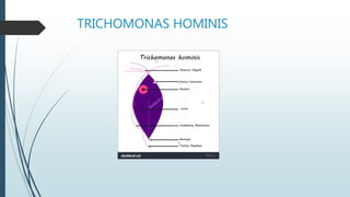 TRICHOMONAS HOMINIS
 