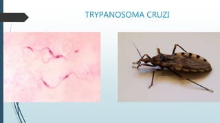 TRYPANOSOMA CRUZI
 