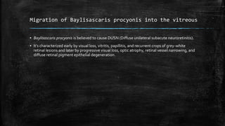 Migration of Baylisascaris procyonis into the vitreous
▪ Baylisascaris procyonis is believed to cause DUSN (Diffuse unilateral subacute neuroretinitis).
▪ It’s characterized early by visual loss, vitritis, papillitis, and recurrent crops of grey‐white
retinal lesions and later by progressive visual loss, optic atrophy, retinal vessel narrowing, and
diffuse retinal pigment epithelial degeneration.
 
