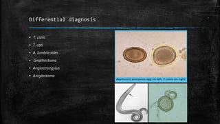 Differential diagnosis
▪ T. canis
▪ T. cati
▪ A. lumbricoides
▪ Gnathostoma
▪ Angiostrongylus
▪ Ancylostoma
 