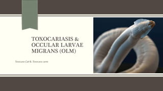 TOXOCARIASIS &
OCCULAR LARVAE
MIGRANS (OLM)
Toxocara Cati & Toxocara canis
 