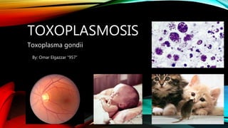 TOXOPLASMOSIS
Toxoplasma gondii
By: Omar Elgazzar “957”
 