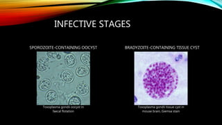 INFECTIVE STAGES
Toxoplasma gondii oocyst in
faecal flotation
Toxoplasma gondii tissue cyst in
mouse brain, Giemsa stain
SPOROZOITE-CONTAINING OOCYST BRADYZOITE-CONTAINING TISSUE CYST
 
