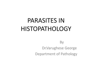 PARASITES IN
HISTOPATHOLOGY
By
Dr.Varughese George
Department of Pathology
 