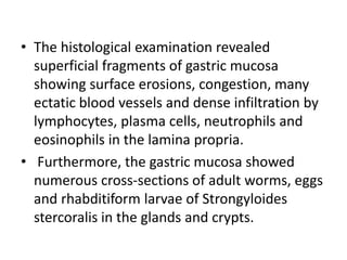 • The histological examination revealed
superficial fragments of gastric mucosa
showing surface erosions, congestion, many
ectatic blood vessels and dense infiltration by
lymphocytes, plasma cells, neutrophils and
eosinophils in the lamina propria.
• Furthermore, the gastric mucosa showed
numerous cross-sections of adult worms, eggs
and rhabditiform larvae of Strongyloides
stercoralis in the glands and crypts.
 