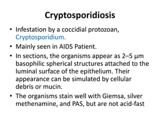 Cryptosporidiosis
• Infestation by a coccidial protozoan,
Cryptosporidium.
• Mainly seen in AIDS Patient.
• In sections, the organisms appear as 2–5 µm
basophilic spherical structures attached to the
luminal surface of the epithelium. Their
appearance can be simulated by cellular
debris or mucin.
• The organisms stain well with Giemsa, silver
methenamine, and PAS, but are not acid-fast
 