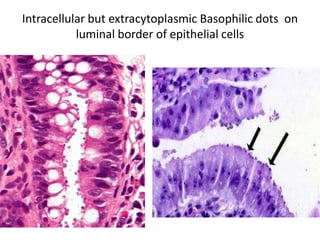 Intracellular but extracytoplasmic Basophilic dots on
luminal border of epithelial cells
 