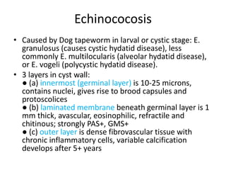 Echinococosis
• Caused by Dog tapeworm in larval or cystic stage: E.
granulosus (causes cystic hydatid disease), less
commonly E. multilocularis (alveolar hydatid disease),
or E. vogeli (polycystic hydatid disease).
• 3 layers in cyst wall:
● (a) innermost (germinal layer) is 10-25 microns,
contains nuclei, gives rise to brood capsules and
protoscolices
● (b) laminated membrane beneath germinal layer is 1
mm thick, avascular, eosinophilic, refractile and
chitinous; strongly PAS+, GMS+
● (c) outer layer is dense fibrovascular tissue with
chronic inflammatory cells, variable calcification
develops after 5+ years
 