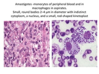 Amastigotes -monocytes of peripheral blood and in
macrophages in aspirates.
Small, round bodies 2–4 μm in diameter with indistinct
cytoplasm, a nucleus, and a small, rod-shaped kinetoplast
 