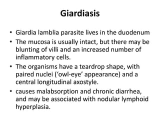 Giardiasis
• Giardia lamblia parasite lives in the duodenum
• The mucosa is usually intact, but there may be
blunting of villi and an increased number of
inflammatory cells.
• The organisms have a teardrop shape, with
paired nuclei (‘owl-eye’ appearance) and a
central longitudinal axostyle.
• causes malabsorption and chronic diarrhea,
and may be associated with nodular lymphoid
hyperplasia.
 
