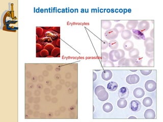 Érythrocytes
Identification au microscope
Érythrocytes parasités
 